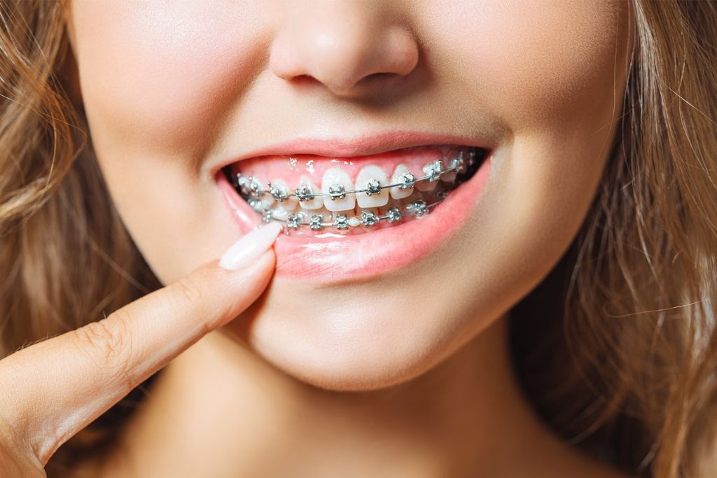 dentist in Cannock town