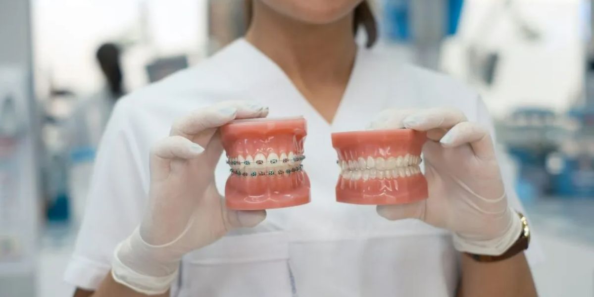 orthodontist braces cost UK