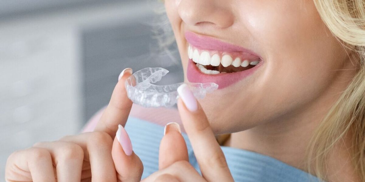 types of braces for teeth