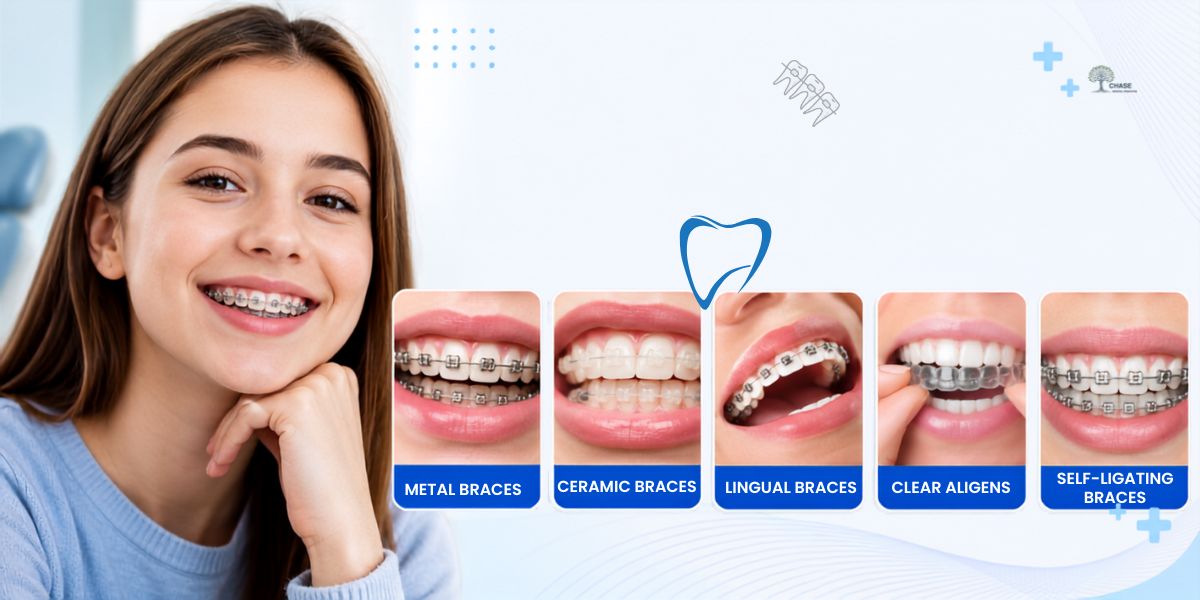 types of braces