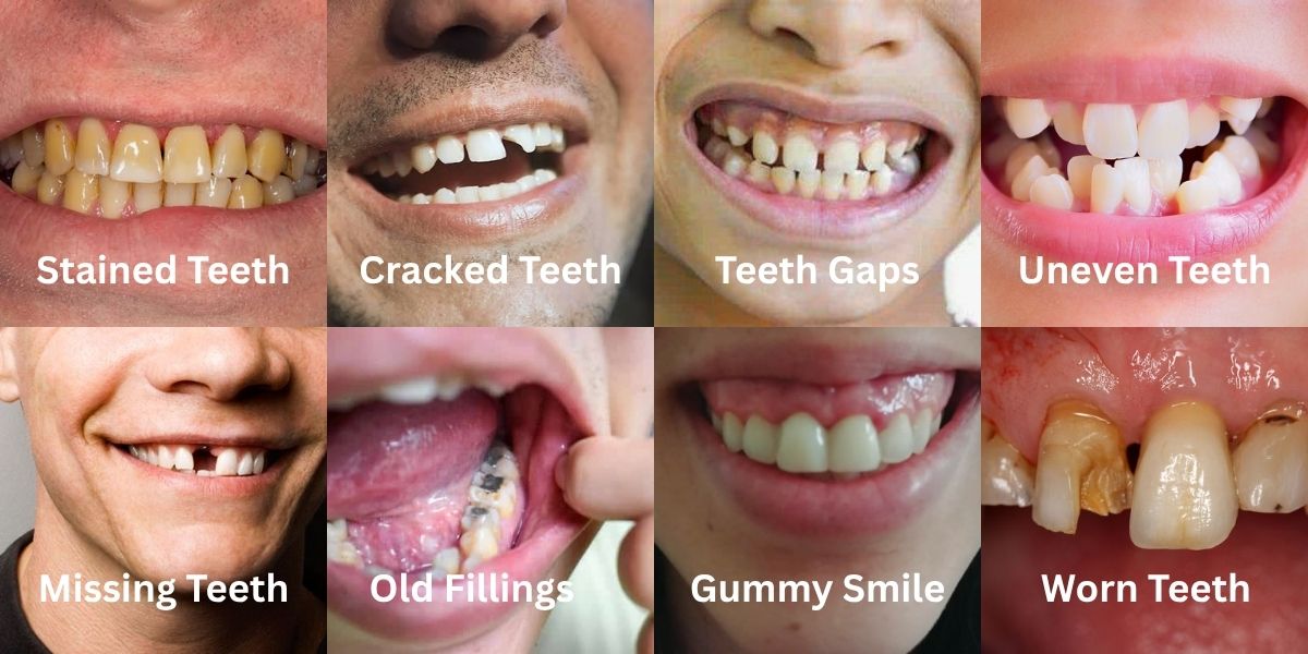 Smile Transformation Cannock