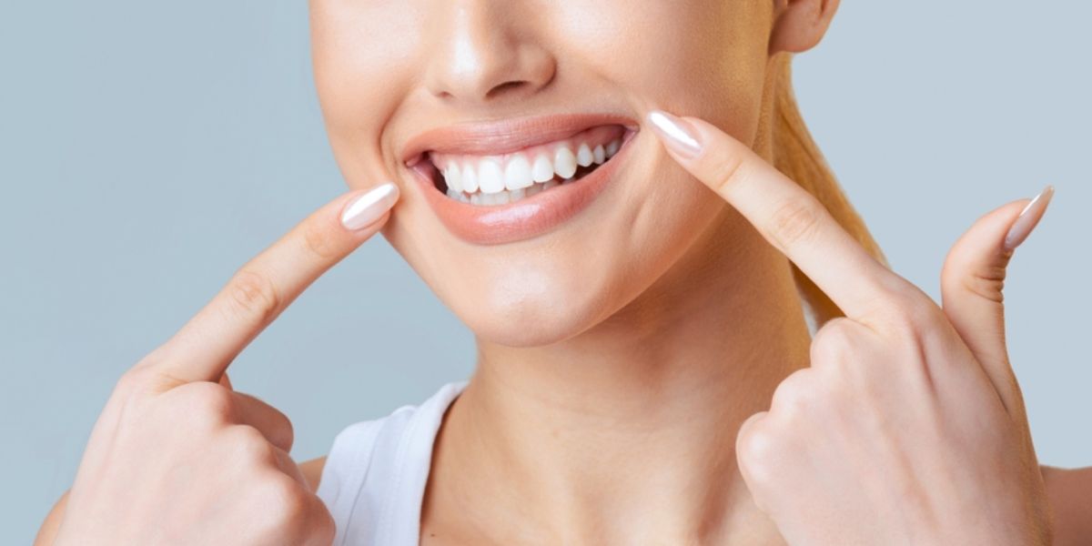 Smile makeover Cannock