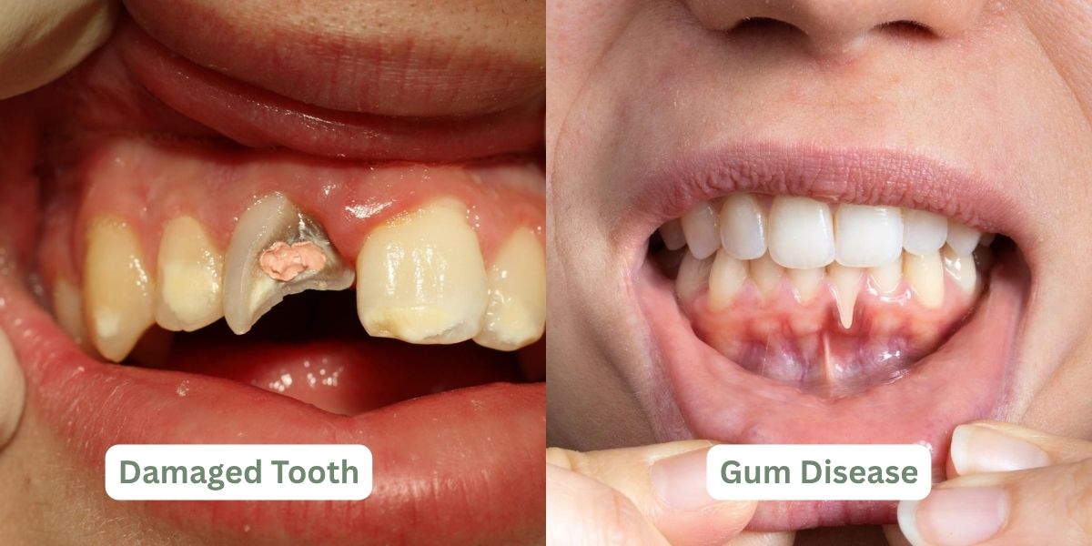 how to stop severe toothache