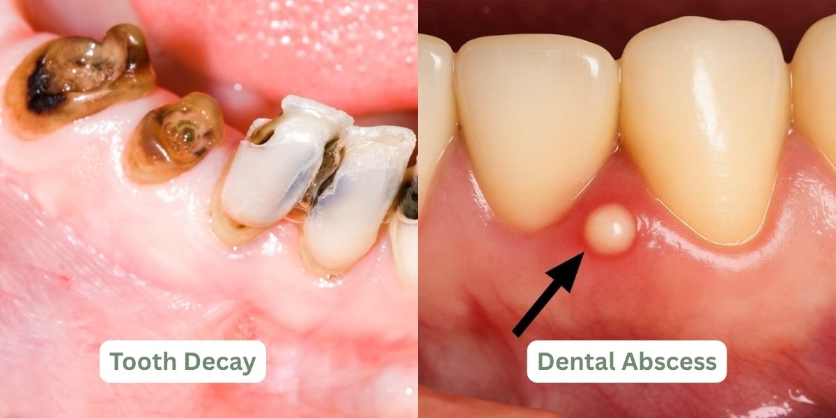 tooth pain Cannock