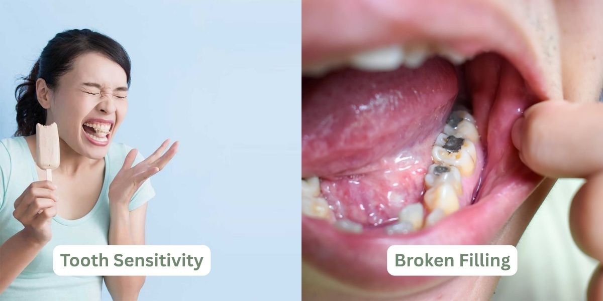 what causes toothache