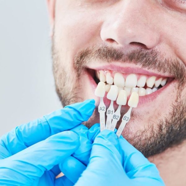 Cosmetic Dentistry in Cannock