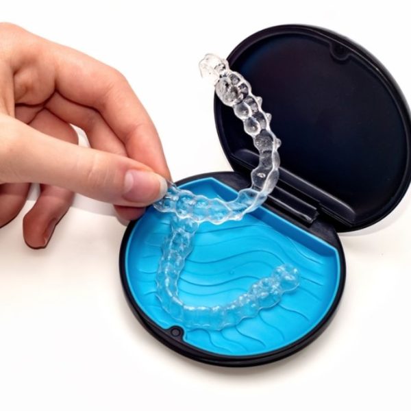 Invisalign Cannock