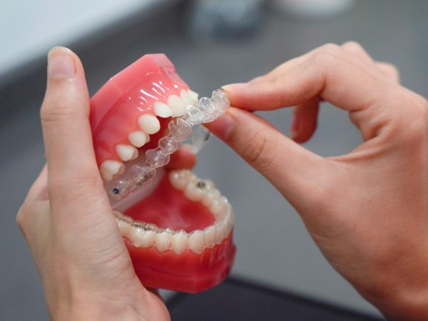 Invisalign