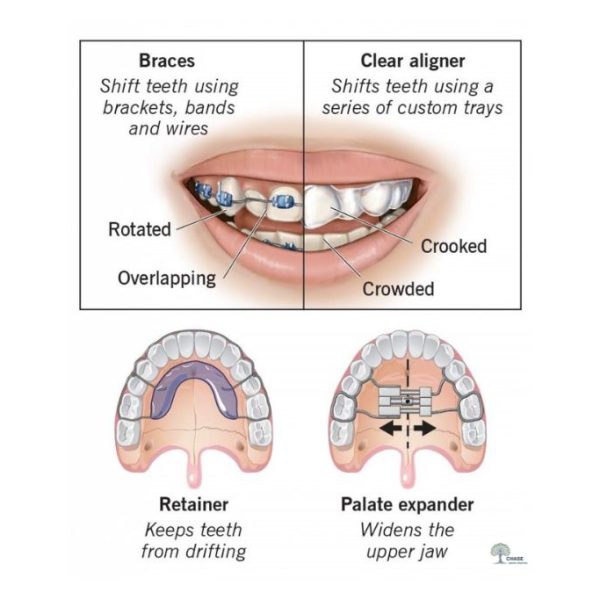 Orthodontist Cannock