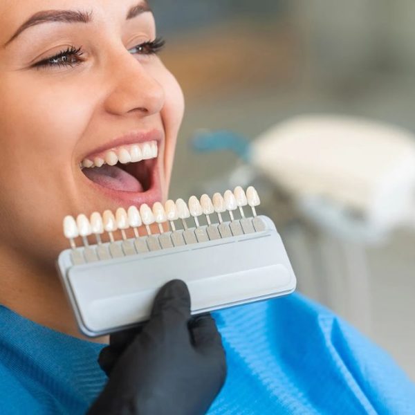 Teeth Whitening in Cannock